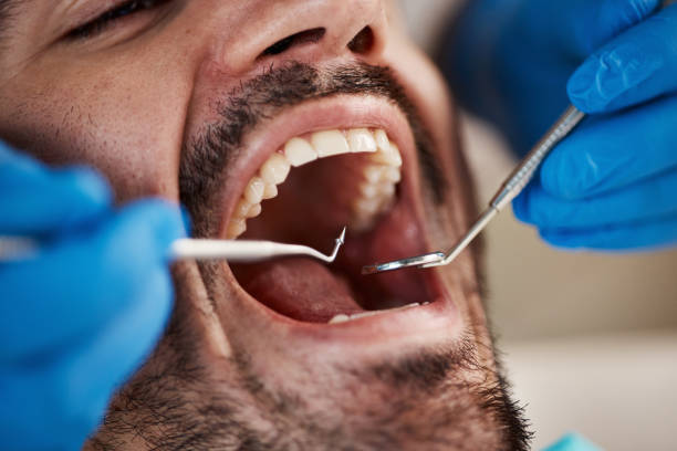 Best Broken or Cracked Tooth Emergency Dentist in Carpentersvle, IL