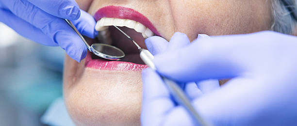 Best Emergency Dental Services for Seniors in Carpentersvle, IL